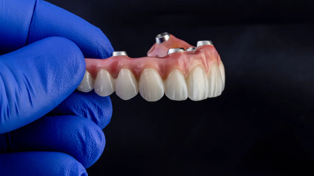 Saúde: Implantes dentários: estética e funcionalidade
