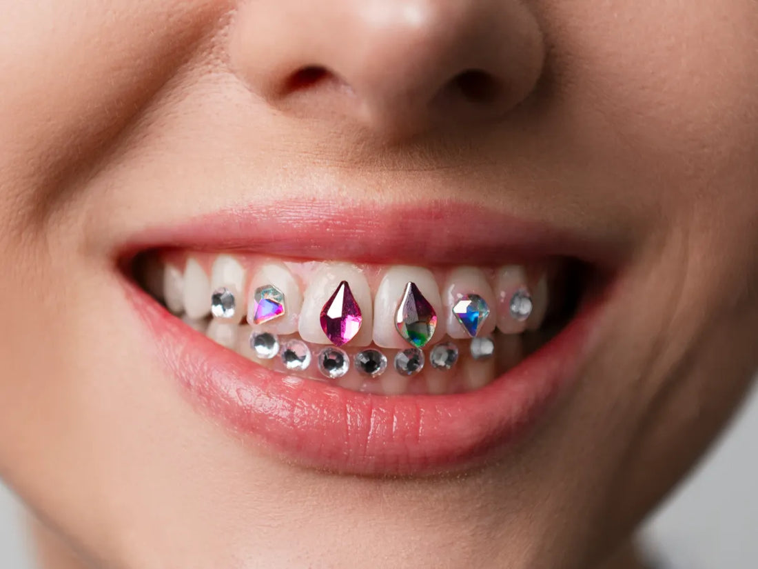As joias também se usam nos dentes, mas há regras a seguir